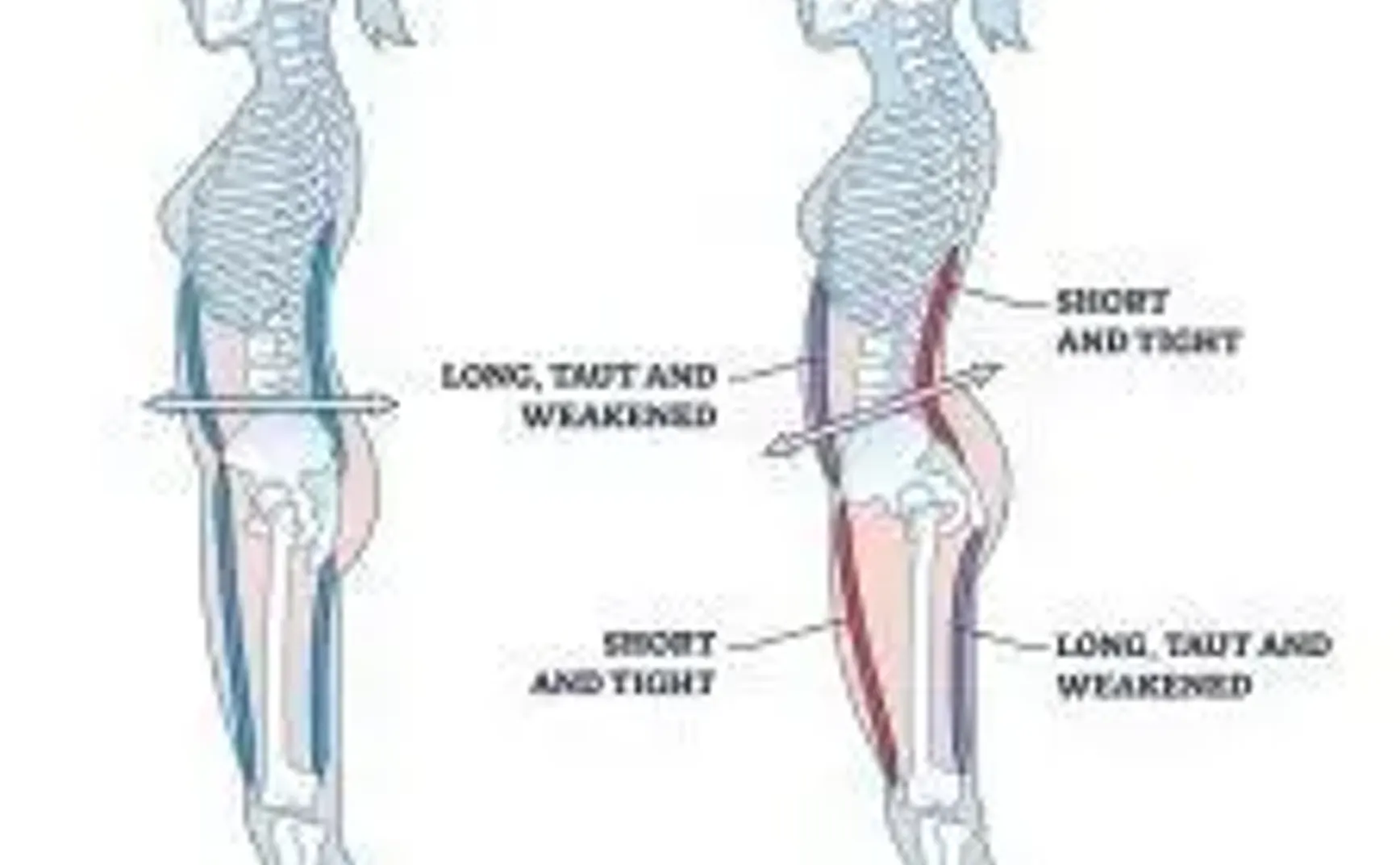 屈髋（Hip Flexion）≠  骨盆前倾（Anterior Pelvic Tilt）
