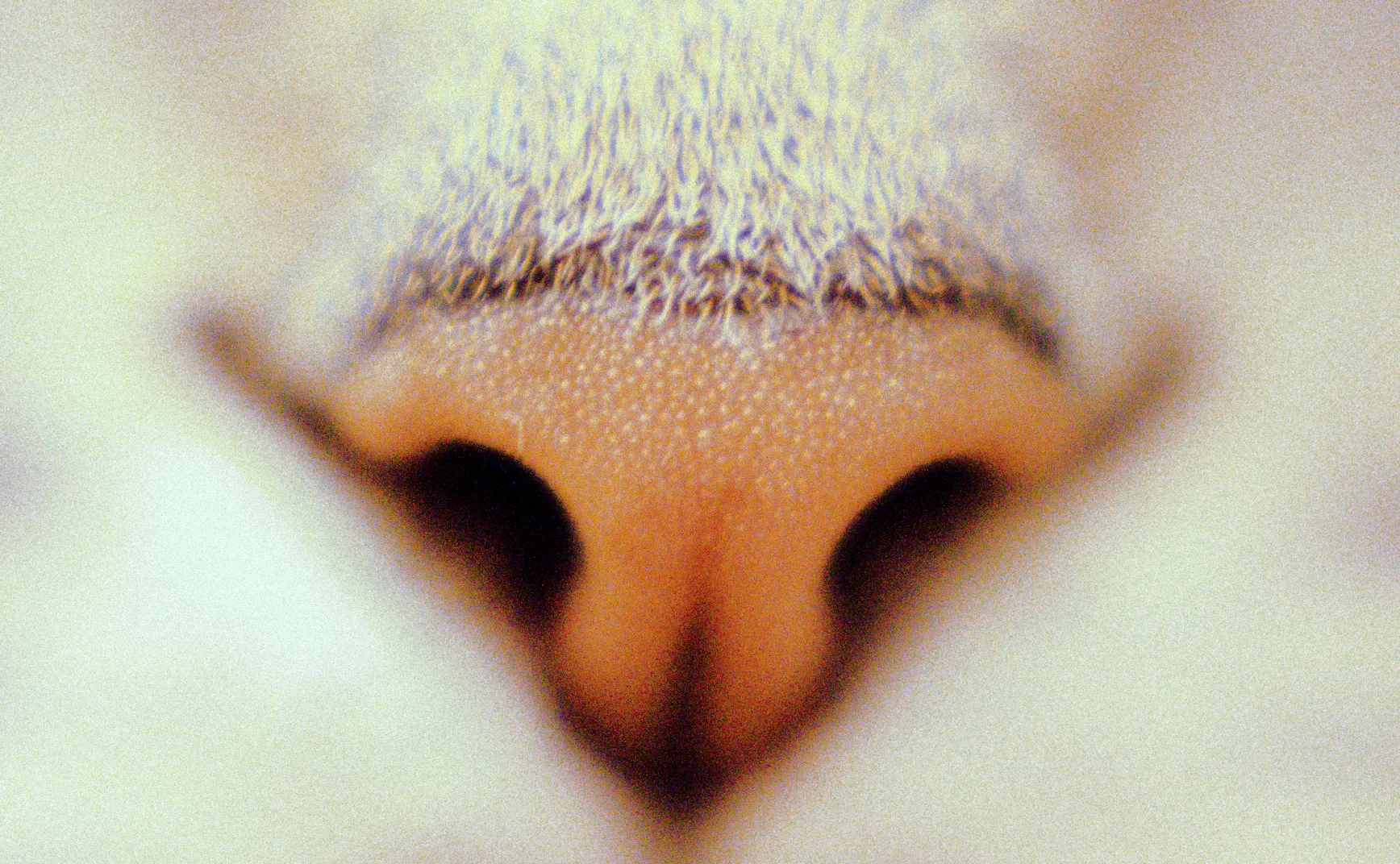 鼻用胰岛素综述