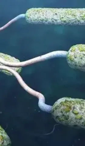 武汉，霍乱确诊，这次是真的甲类传染病