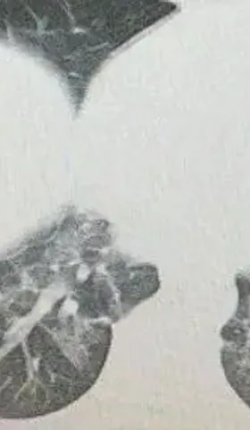 是谁在用大白肺吓唬我们？
