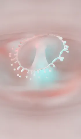 ICL对晶状体散光的生物力学影响:基于文献的潜在次级效应分析