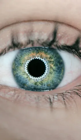 AI辅助泛读样例：角膜塑形镜研究进展综述