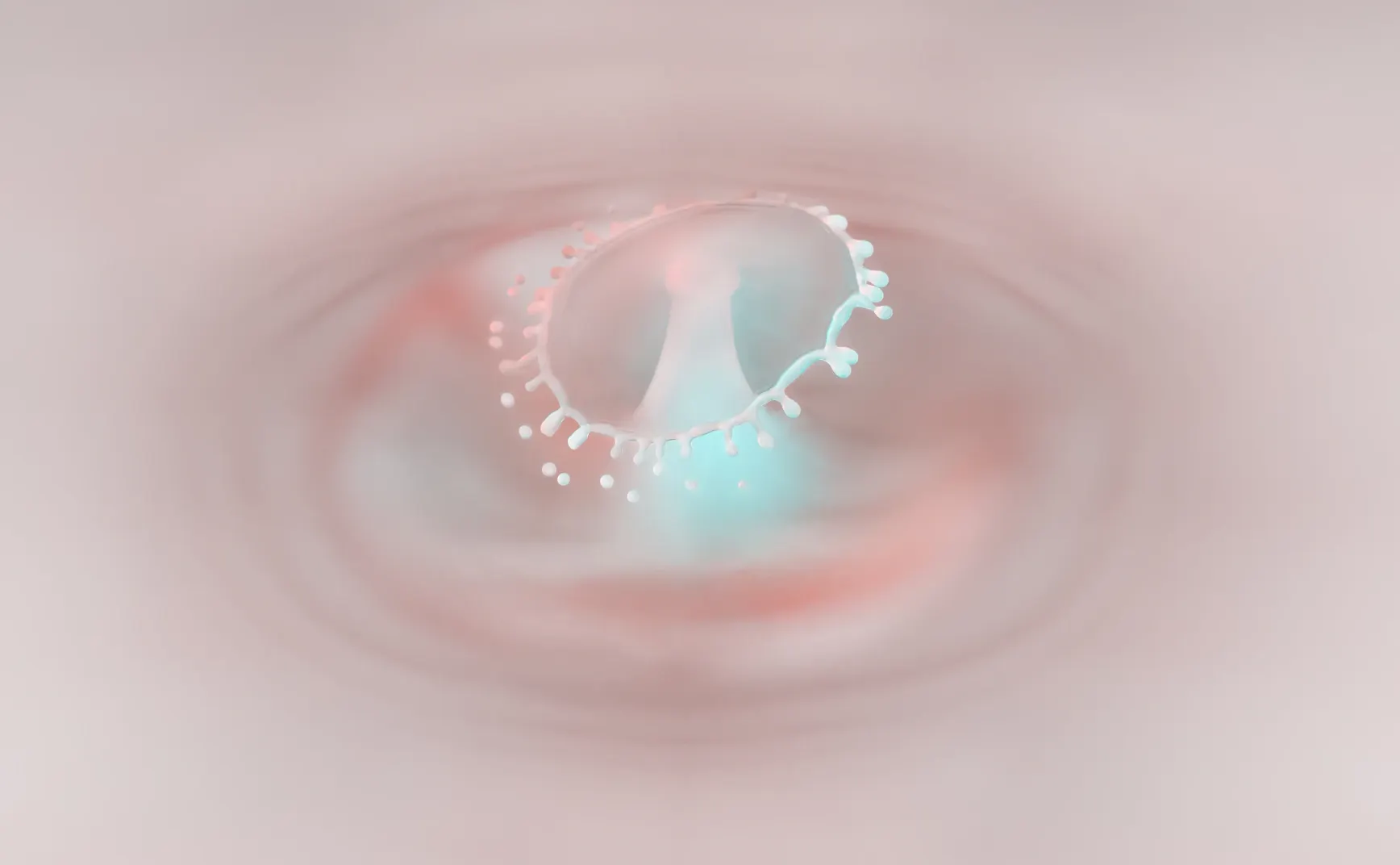 ICL对晶状体散光的生物力学影响:基于文献的潜在次级效应分析