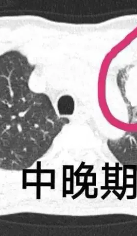 能杀死所有实体癌瘤的新药又被媒体研发出来了