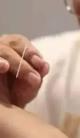 那些无效的治疗方法为什么有人会觉得有效？