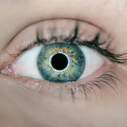 AI辅助泛读样例:角膜塑形镜研究进展综述